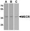 Mitochondrial Trans-2-Enoyl-CoA Reductase antibody, A08189, Boster Biological Technology, Western Blot image 