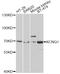 Potassium Voltage-Gated Channel Subfamily Q Member 1 antibody, A2174, ABclonal Technology, Western Blot image 