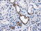 Protein Phosphatase Methylesterase 1 antibody, M08083, Boster Biological Technology, Immunohistochemistry paraffin image 