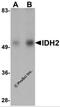 Isocitrate Dehydrogenase (NADP(+)) 2, Mitochondrial antibody, 5821, ProSci, Western Blot image 