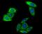 Hexokinase Domain Containing 1 antibody, NBP2-76936, Novus Biologicals, Immunocytochemistry image 