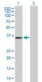 Ankyrin Repeat Family A Member 2 antibody, H00057763-B01P, Novus Biologicals, Western Blot image 