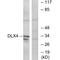 Distal-Less Homeobox 4 antibody, A04975, Boster Biological Technology, Western Blot image 
