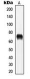 LIM Domain Kinase 1 antibody, MBS820333, MyBioSource, Western Blot image 