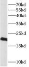 Phospholipase A And Acyltransferase 4 antibody, FNab07124, FineTest, Western Blot image 