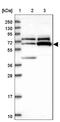 Zinc Finger Protein 329 antibody, NBP1-92622, Novus Biologicals, Western Blot image 