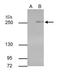 Tet Methylcytosine Dioxygenase 2 antibody, NBP2-43579, Novus Biologicals, Immunoprecipitation image 