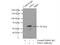 Serine/Threonine Kinase 4 antibody, 22245-1-AP, Proteintech Group, Immunoprecipitation image 