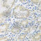 Transglutaminase 2 antibody, A0981, ABclonal Technology, Immunohistochemistry paraffin image 