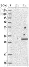 WDYHV Motif Containing 1 antibody, NBP1-86722, Novus Biologicals, Western Blot image 