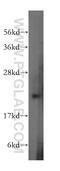 RAB31, Member RAS Oncogene Family antibody, 15485-1-AP, Proteintech Group, Western Blot image 