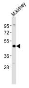 Indian Hedgehog Signaling Molecule antibody, MBS9213903, MyBioSource, Western Blot image 