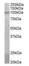 ATP/GTP Binding Protein Like 5 antibody, orb125184, Biorbyt, Western Blot image 