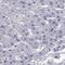 AT-Rich Interaction Domain 3A antibody, NBP1-89938, Novus Biologicals, Immunohistochemistry paraffin image 