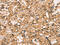 C-X-C Motif Chemokine Receptor 6 antibody, CSB-PA224134, Cusabio, Immunohistochemistry frozen image 