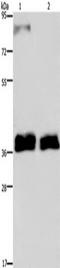 Fetuin B antibody, TA349975, Origene, Western Blot image 