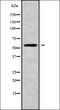 Calcium/Calmodulin Dependent Protein Kinase II Delta antibody, orb338096, Biorbyt, Western Blot image 