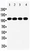 Signal Transducer And Activator Of Transcription 2 antibody, PA1509, Boster Biological Technology, Western Blot image 