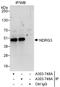 Protein NDRG3 antibody, A303-748A, Bethyl Labs, Immunoprecipitation image 