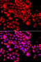 Activating Signal Cointegrator 1 Complex Subunit 3 antibody, 23-311, ProSci, Immunofluorescence image 