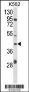 DHHB-MTase antibody, MBS9205558, MyBioSource, Western Blot image 