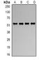 RB Binding Protein 4, Chromatin Remodeling Factor antibody, orb340757, Biorbyt, Western Blot image 