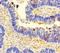 Coiled-Coil Domain Containing 66 antibody, LS-C396072, Lifespan Biosciences, Immunohistochemistry paraffin image 