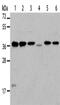 NFKB Inhibitor Alpha antibody, CSB-PA984502, Cusabio, Western Blot image 