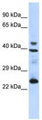 Selenoprotein P antibody, TA335922, Origene, Western Blot image 