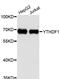 YTH N6-Methyladenosine RNA Binding Protein 1 antibody, A13260, ABclonal Technology, Western Blot image 