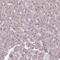 DNA Polymerase Delta 1, Catalytic Subunit antibody, NBP2-33466, Novus Biologicals, Immunohistochemistry paraffin image 