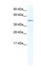 Iroquois Homeobox 3 antibody, NBP1-80217, Novus Biologicals, Western Blot image 