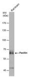 Paxillin antibody, PA5-34910, Invitrogen Antibodies, Western Blot image 