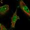Lemur Tyrosine Kinase 2 antibody, HPA041836, Atlas Antibodies, Immunocytochemistry image 