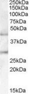 UDP-GlcNAc:BetaGal Beta-1,3-N-Acetylglucosaminyltransferase 2 antibody, NBP1-00158, Novus Biologicals, Western Blot image 