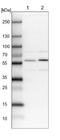 Family With Sequence Similarity 178 Member B antibody, NBP1-93539, Novus Biologicals, Western Blot image 