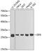 Eukaryotic Translation Initiation Factor 6 antibody, 18-314, ProSci, Western Blot image 