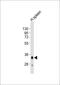 Major Histocompatibility Complex, Class II, DQ Alpha 1 antibody, M00232-2, Boster Biological Technology, Western Blot image 