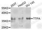 Alpha Tocopherol Transfer Protein antibody, A8562, ABclonal Technology, Western Blot image 