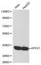 Leukotriene A4 Hydrolase antibody, LS-C192268, Lifespan Biosciences, Western Blot image 