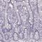 Keratin 34 antibody, PA5-67227, Invitrogen Antibodies, Immunohistochemistry paraffin image 