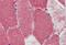 POLG antibody, NBP1-52300, Novus Biologicals, Immunohistochemistry paraffin image 
