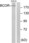 BCL6 Corepressor antibody, LS-C119397, Lifespan Biosciences, Western Blot image 