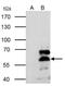 Retinoid X Receptor Alpha antibody, NBP2-20130, Novus Biologicals, Immunoprecipitation image 