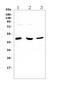 Mannose Phosphate Isomerase antibody, A00175, Boster Biological Technology, Western Blot image 