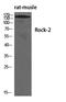 Rho Associated Coiled-Coil Containing Protein Kinase 2 antibody, STJ95528, St John