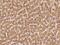 GGCX antibody, 203333-T10, Sino Biological, Immunohistochemistry paraffin image 