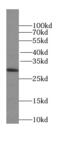 Spindlin 1 antibody, FNab08178, FineTest, Western Blot image 