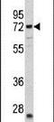 Carnitine O-Acetyltransferase antibody, PA5-13505, Invitrogen Antibodies, Western Blot image 