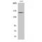 MutS Homolog 6 antibody, LS-C383879, Lifespan Biosciences, Western Blot image 